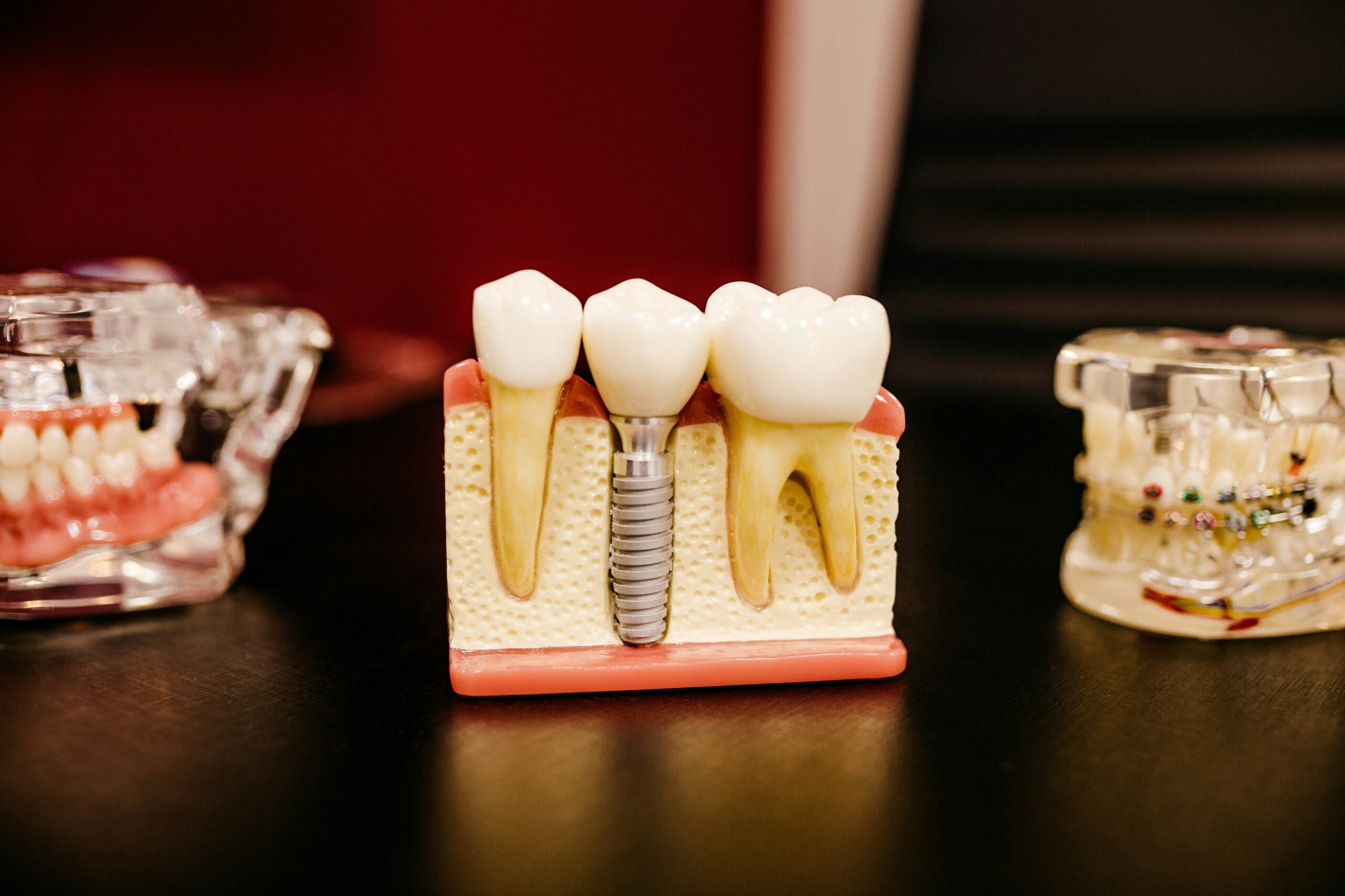 Dental and oral health