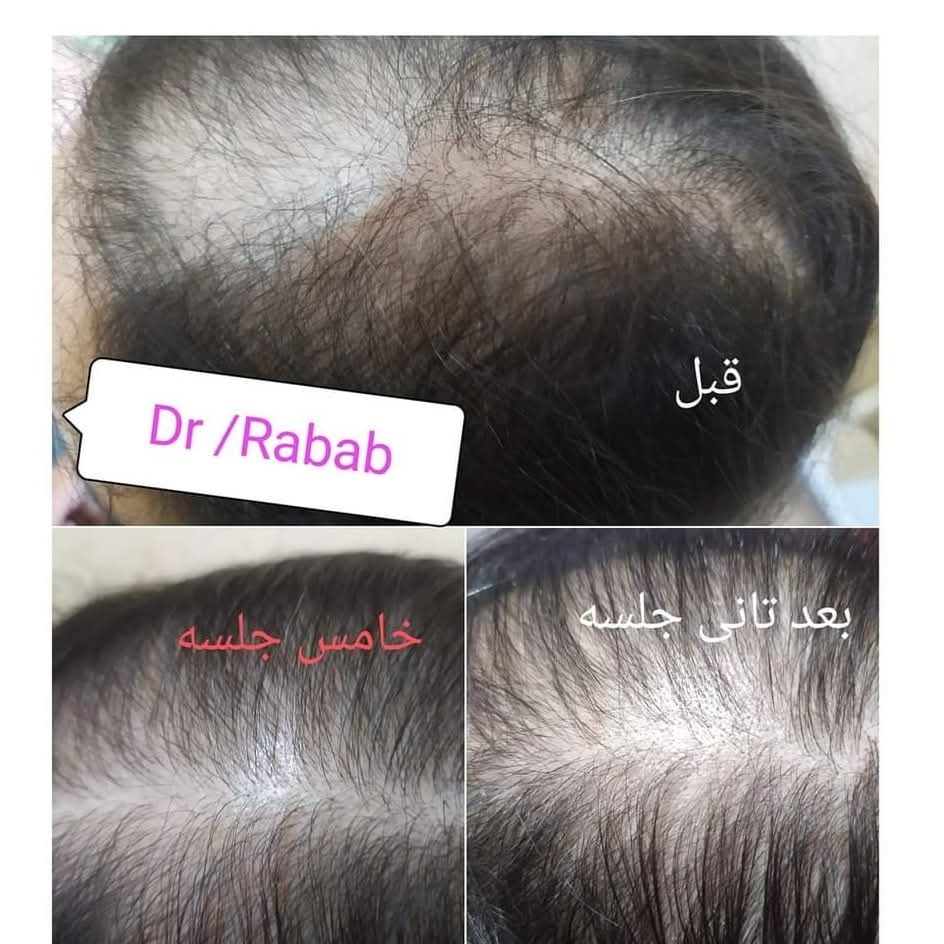 Rabab Osman - portfolio - 1