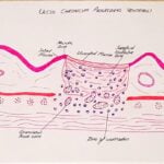 Je réaliserai des illustrations médicales à haut rendement, des schémas d’histologie et des croquis de pathologie